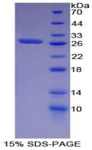 SDS-PAGE